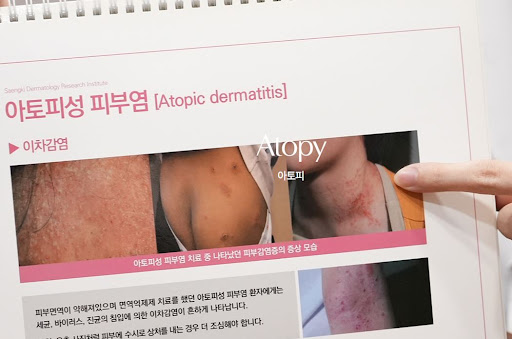 생기한의원으로 확인하는 아토피 피부 장벽 이상 관련 정보